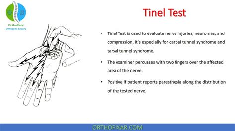 median nerve compression testing vs tinel|tinel sign test results.